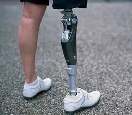 居家生活，假肢和矫形器消毒小妙招(图2)